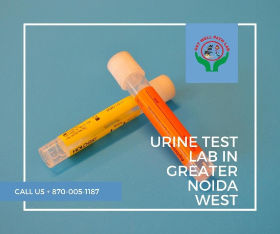 urine-test-lab-in-greater-noida-west-big-0