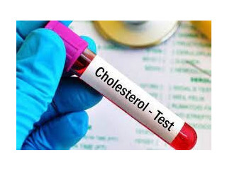 Cholesterol Test at San Jose
