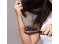top-hair-doctor-in-noida-alopecia-herbal-treatment-for-alopecia-hair-fall-small-0