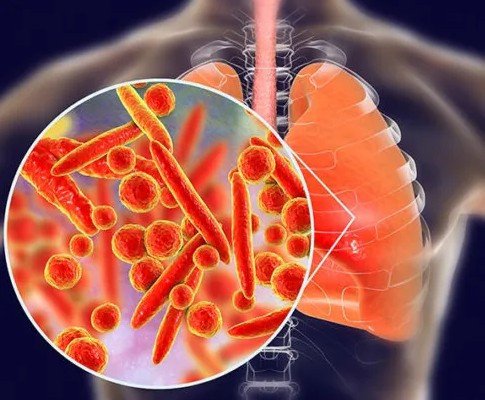 lung-cancer-diagnosis-treatment-specialist-in-ajmer-rajasthan-dr-sheetu-singh-big-0